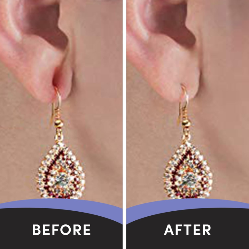 - Clear Earring Support Patches - Earring Backs for Droopy Ears - Ear Care Produ