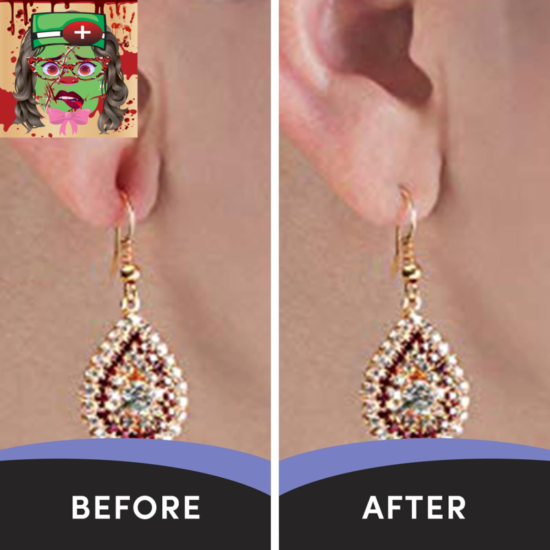 - Clear Earring Support Patches - Earring Backs for Droopy Ears - Ear Care Produ